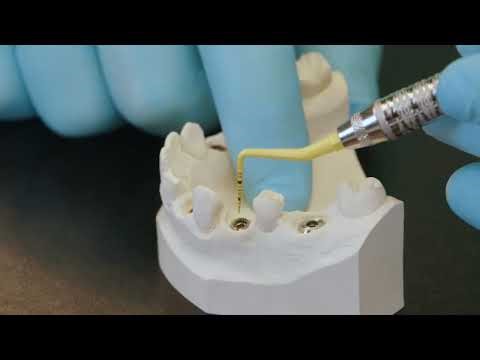 Service Set for TorcFit connection