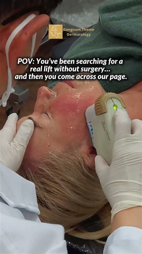 Ultherapy 💆‍♀️ | Lift, Tighten & Sculpt Your Skin Without Surgery