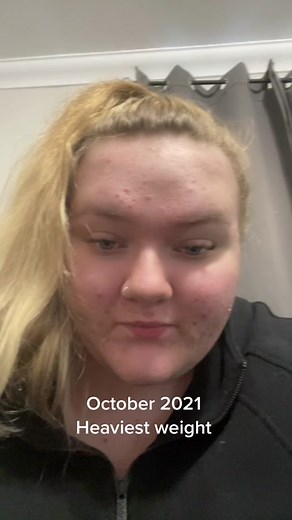 Officially 1 year post-op and 135lbs lost. Best thing I’ve ever done! #bariatricsurgery #weightloss #transformation #greenscreen