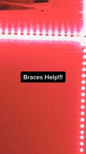 #voiceeffects #braceshelp #pt1 #commentanyquestions #braces #fyp #foryou