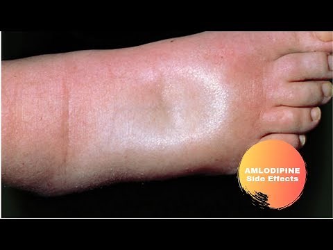 Tablet Amlodipine 2.5 mg and 5 mg - Amlodipine is used for Hypertension