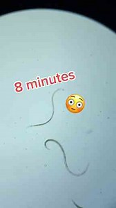 Tiny but Wild: Meet the Nematode