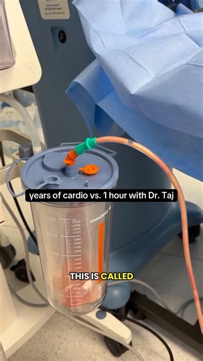 Kambiz Tajkarimi, MD | Years of cardio vs 1 hour with Dr. Taj... #menshealth #confidenceboost #urology #foxnews #beforeandafter | Instagram