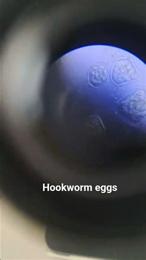 Hookworm eggs under microscope - N. americanus/A. duodenale