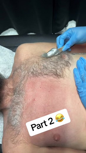 Part 2 as promised 😂😂 my boy look so clean though 🙌🏾💪🏾🫶🏾 #fyp #foryou #hairychest #chestwax #chestwaxing #firtstimer #estheticianlife #estheticiantiktok #hairremoval #waxstrip #lol #waxing #novawax #waxingqueenadventures #faroundandfindout #hewasntready #funnymoments #funnyvideos #satisfying #viral #viralvideo #viraltiktok