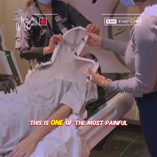 The Most Painful Mask in the World — The Radiation Therapy Mask. #science