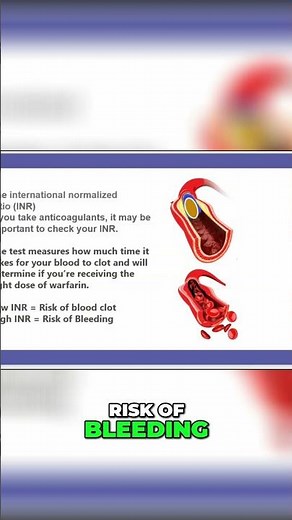2-Minute INR & Blood Clots: When Should You Stop Anticoagulation? #shorts