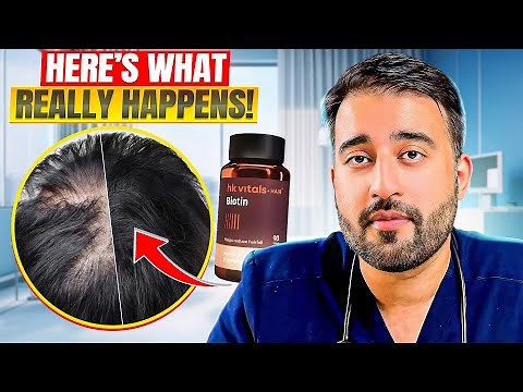 Biotin & Hair Loss – Here’s What Really Happens!