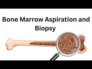 Bone Marrow Aspiration and Biopsy: Procedure, Preparation, and Risks Explained