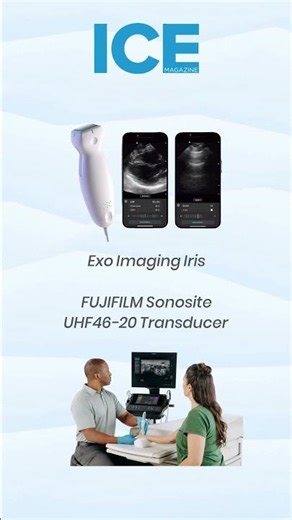 All Things Ultrasound Probes and Transducers