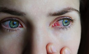 Glaucoma: le ultime terapie più innovative per combatterlo