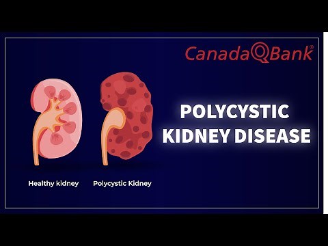 Polycystic Kidney Disease (PKD): Symptoms, Genetics & Treatment | Nephrology High-Yield