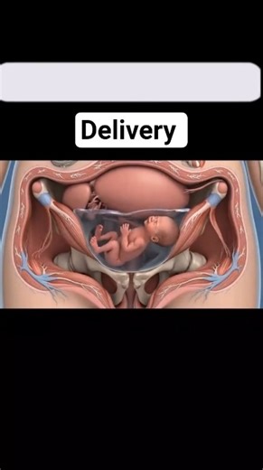 Baby delivery process inside view #baby #delivery #pregnantwomen