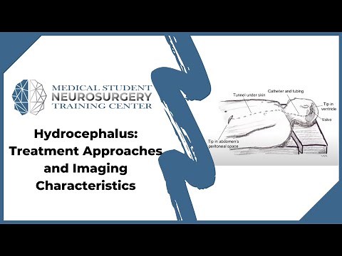Hydrocephalus: Treatment Approaches and Imaging Characteristics