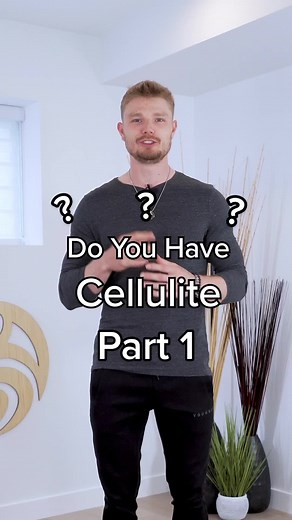 Understanding Cellulite: The Role of Fascia in Cellulite Development