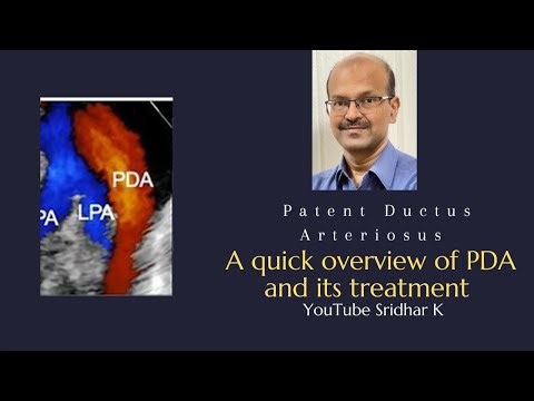 Patent ductus arteriosus and approach to PDA treatment. Dr Sridhar K