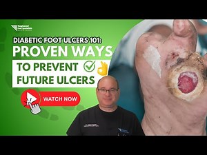 Diabetic Foot Ulcers 101: How to Prevent Ulcers from Coming Back