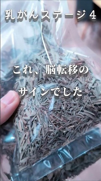 【乳癌ステージ4】脳転移のサインでした