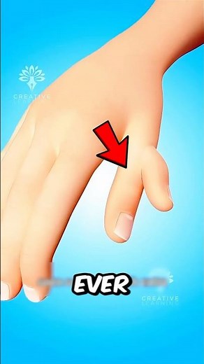 Why do some people have extra fingers or toes😱