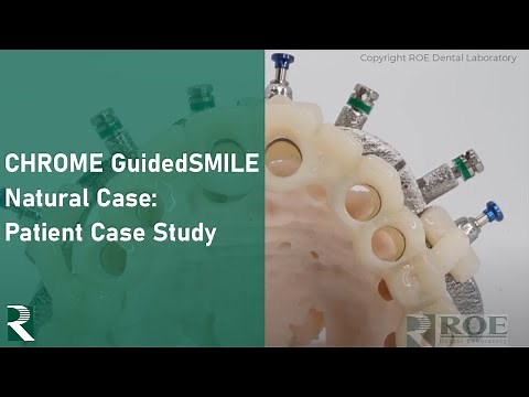 CHROME GuidedSMILE Natural: Patient Case Study