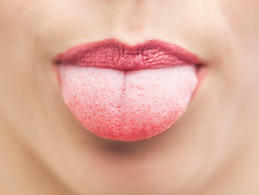 All the Possible Reasons Your Taste Buds Might Be Swollen, According to Doctors