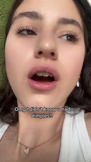 Understanding Dimples: Claudia's World of Deep Dimples