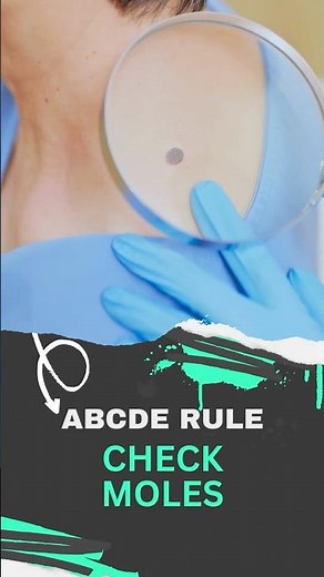 How to Check Your Skin for Cancer in 40 Seconds