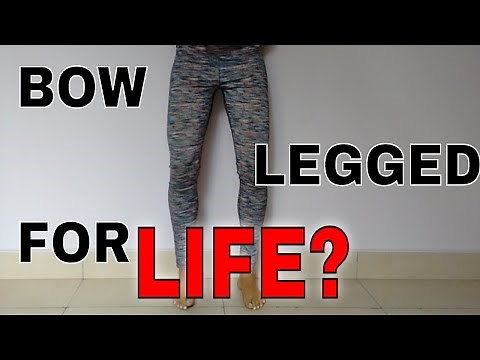 BOW LEGS YOGA - How To Get Straight Legs Naturally? (The Absolute Truth!)