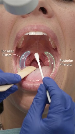 throat swab culture test #usashorts #usnurse #aishorts #mbbs #learning #education #onlineclasses