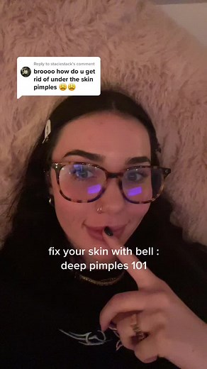 Under the Skin Spot Treatment: Deep Pimples 101