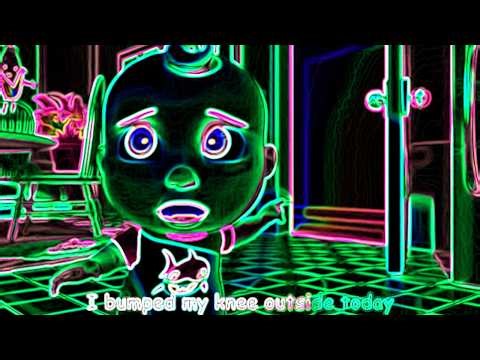 Cocomelon The Boo Boo Song Vocoded | 2026 Funny Revision
