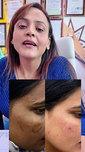 10K views · 84 reactions | Skin care 9266414235 #facetreatment #faceglow #facebrightening #skincare #viral #nishalambha | Nisha Lambha - Sparsh Beauty Care & Hair Treatment LLP | Facebook