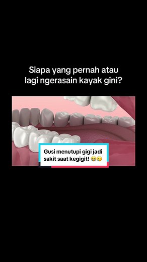 Perikoronitis: Kenali Kondisi Gigi Bungsu Tumbuh Miring dan Penanganannya