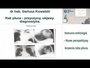 Rak płuca - przyczyny, objawy, diagnostyka