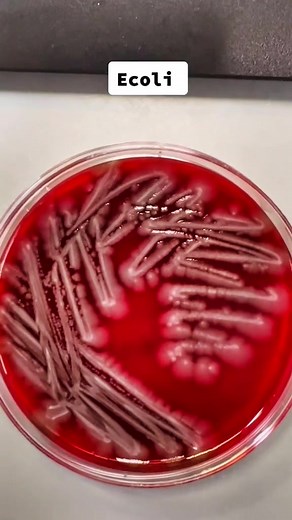 Understanding E. Coli on Toilet Seats: Prevention and Hygiene Tips