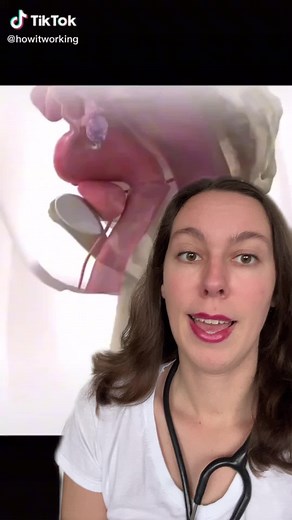 Das nennt man auch Gebärmuttersenkung und wenn man die Gebärmutter von außen sehen kann, heißt es Gebärmuttervorfall #fragdieärztin #medizin #uterus