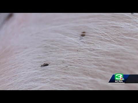 How to get rid of fleas