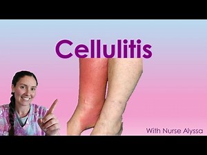Cellulitis