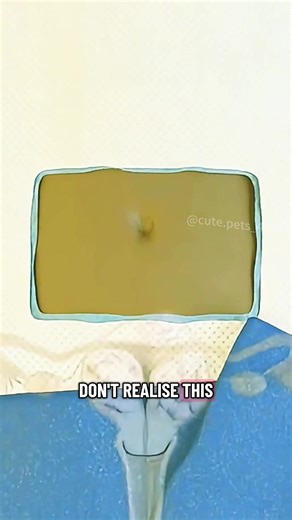 Uterine Fibroid Embolization (3D Animation) #uterinefibroidembolization #uterinefibroids #uterinefibroidembolizationprocedure #uterinefibroid #embolization #medical #animation #health #medicalanimation #uterine #fyp