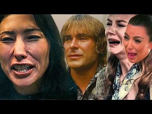 when actors go crazy on botox