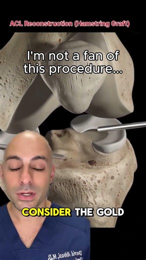 This procedure can RUIN your hamstring...