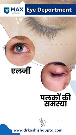 Know about watery eyes, symptoms, and solutions | treatments #eyecare #eyes