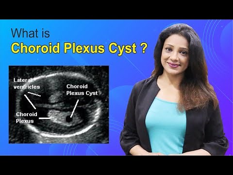 Cyst in Baby’s Brain | how Dangerous | it can be ?