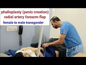 Phalloplasty for female to male transgenders by radial artery forearm flap INDIA USA UK BANGLADESH