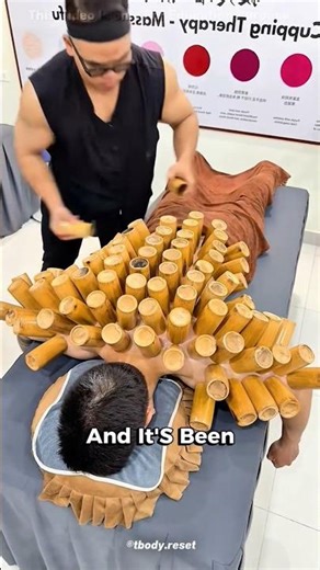 What Really Happens in Cupping Therapy 🤯