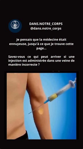DANS.NOTRE_CORPS on Instagram: "une injection intraveineuse mal réalisée peut entraîner plusieurs problèmes. Le médicament peut pénétrer trop rapidement dans la circulation sanguine, provoquant des vertiges, des nausées, une chute de tension artérielle, voire des effets indésirables graves. De plus, une ponction incorrecte peut irriter la veine et causer douleur, ecchymose ou inflammation au point d’injection. Dans les cas les plus graves, le médicament peut s’infiltrer dans les tissus environna