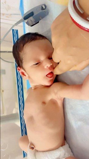 Rooting reflex in newborn baby