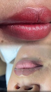 1.2K views |  Get the Perfect Pout with Full Lip Blush! At Skinlex...