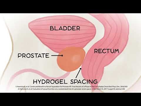 How Does SpaceOAR Work?