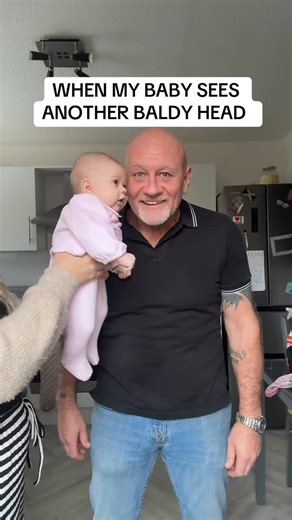 Megan Burns | Cutest baldy head (Winnie ofc🤪😂) #mumlife #mumblog #mumsoninstagram #mum #explore | Instagram